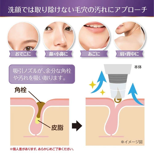 Pore Spot電子吸黑頭粉刺機